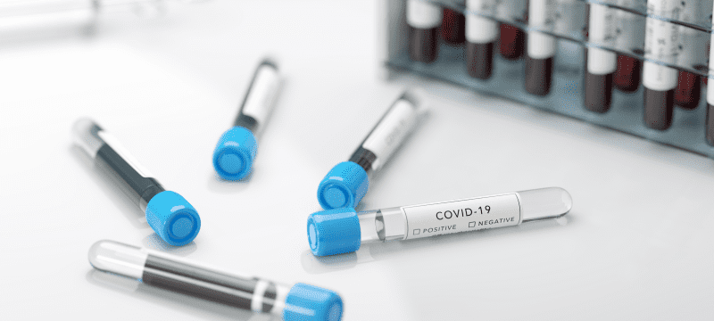 testy na przeciwciała koronawirusa